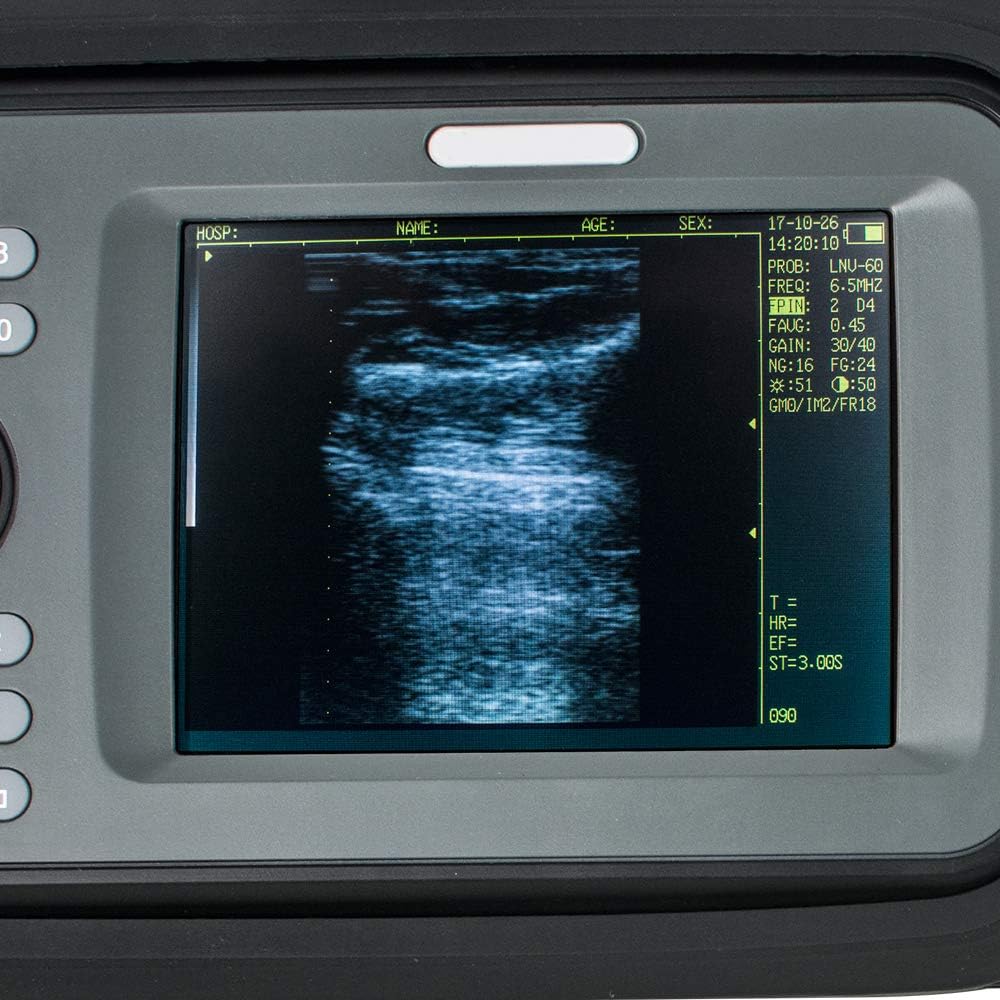 Portable Handheld Scanner Veterinary Digital Machine with 6.5MHz Rectal Handle J51934