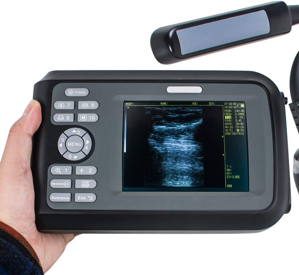 Portable Handheld Scanner Veterinary Digital Machine with 6.5MHz Rectal Handle J51934